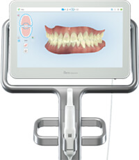 iTeroスキャニングシステム