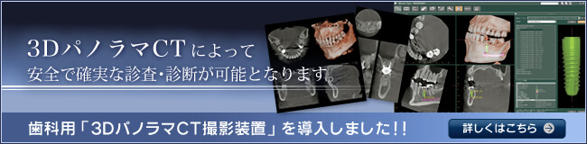 インプラントや矯正治療など、様々な治療を正確に診断します。