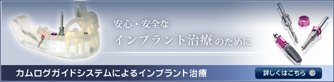 安心・安全なインプラントつ治療のために。カムログガイドシステムによるインプラント治療