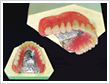 義歯について