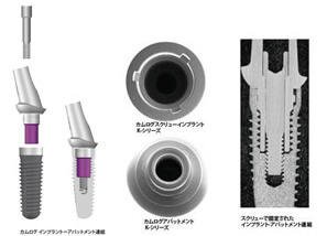 カムログインプラントの特徴